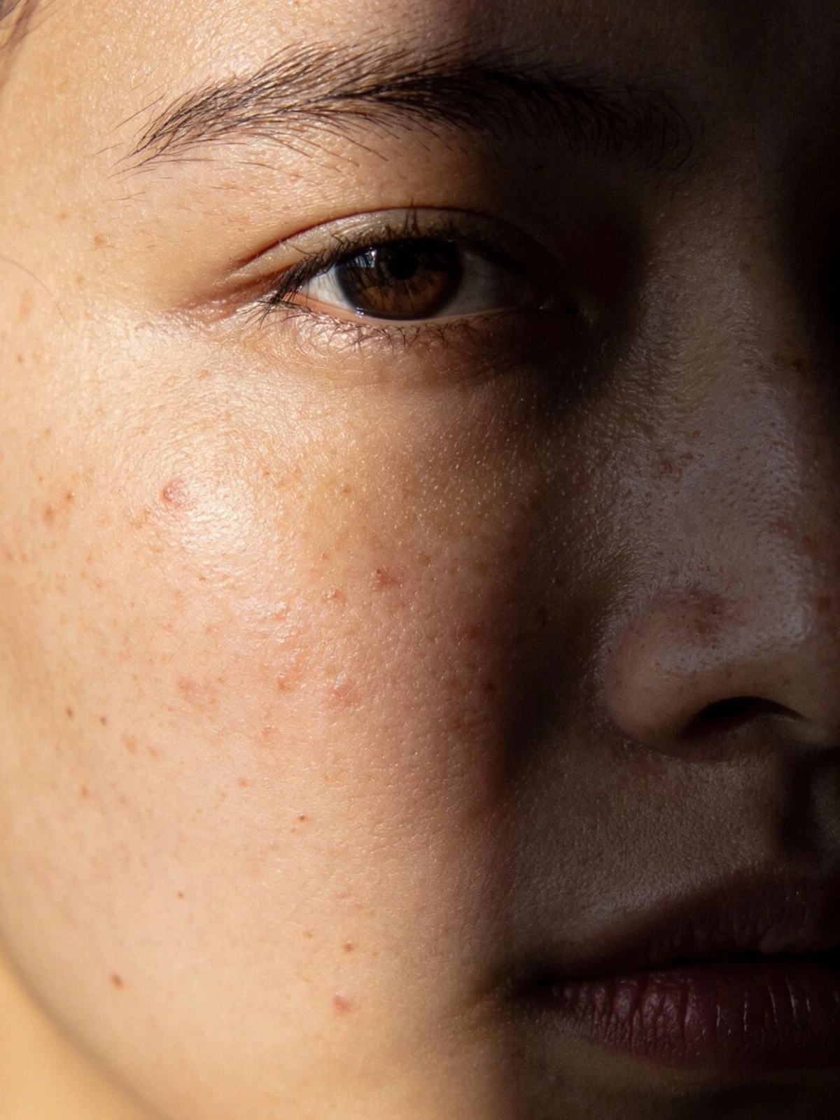 照片祛除瑕疵前示例照片